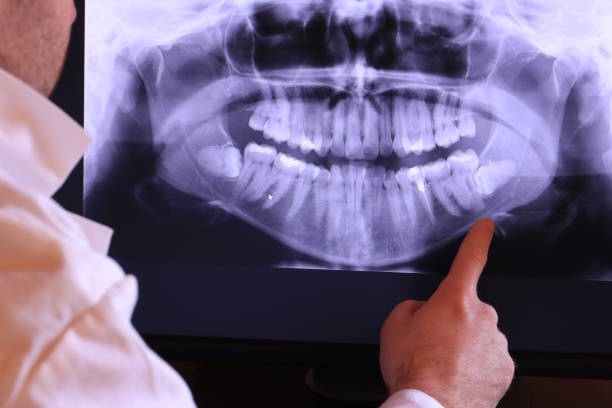Best Root Canal Emergency Dentist  in Charlevoix, MI